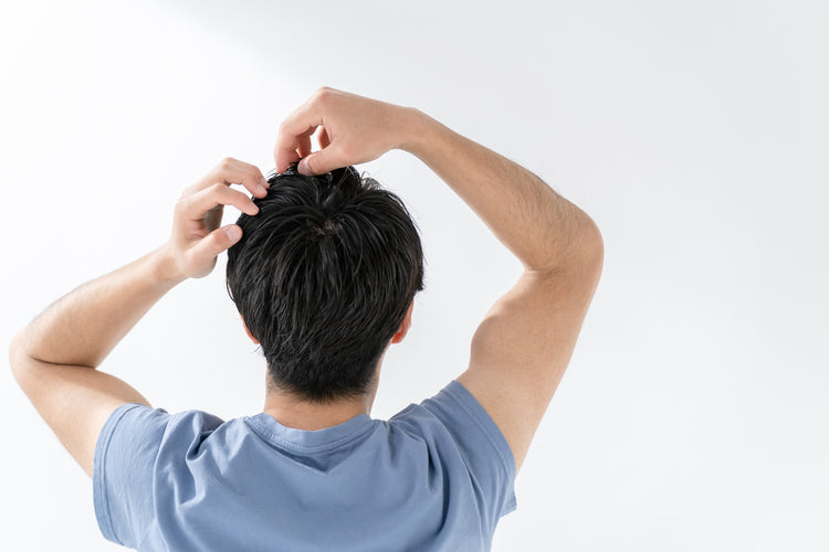 AGAの抜け毛・症状の特徴やハゲやすい人の特徴について解説